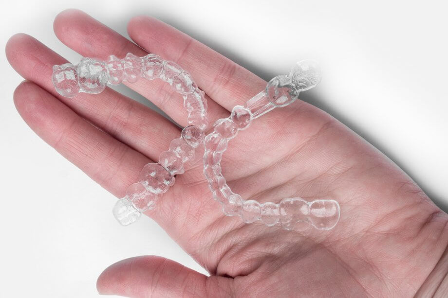 Invisalign - Clear Aligners