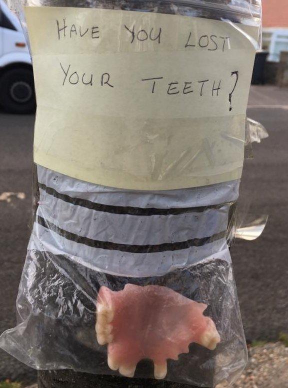 dentures