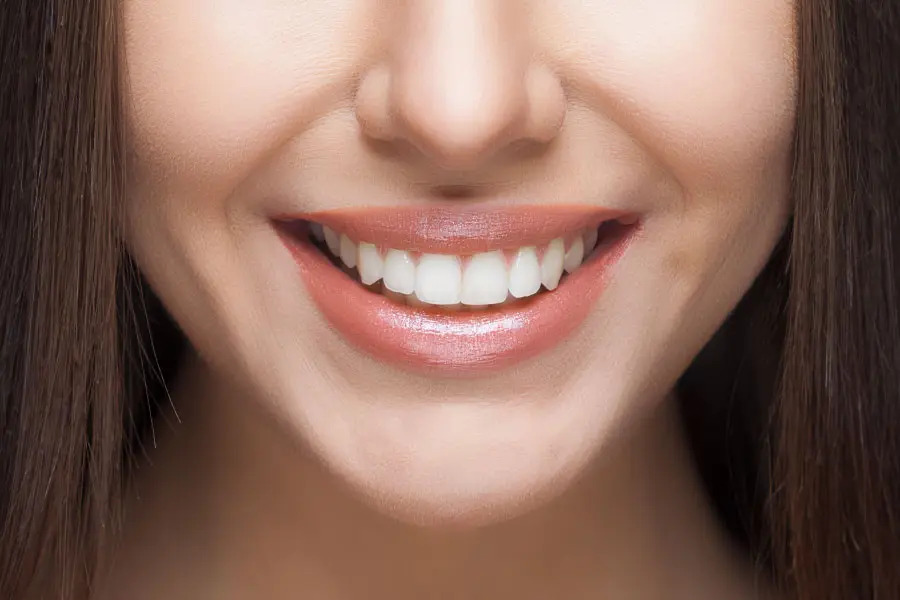Teeth whitening solutions
