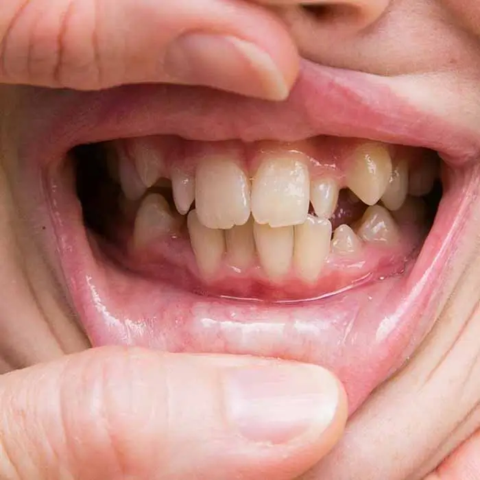 Client Case 1 Wonky Teeth