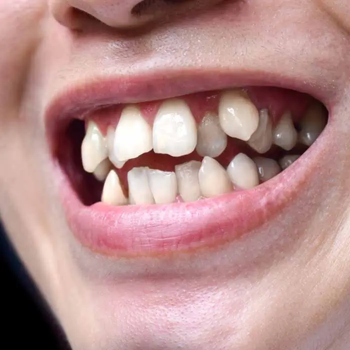 Client Case 3 Wonky Teeth