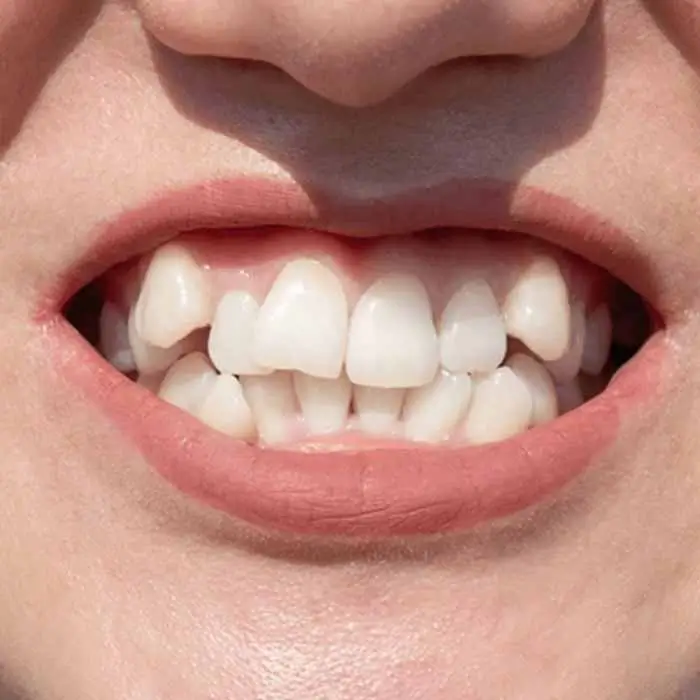 Client Case 5 Wonky Teeth