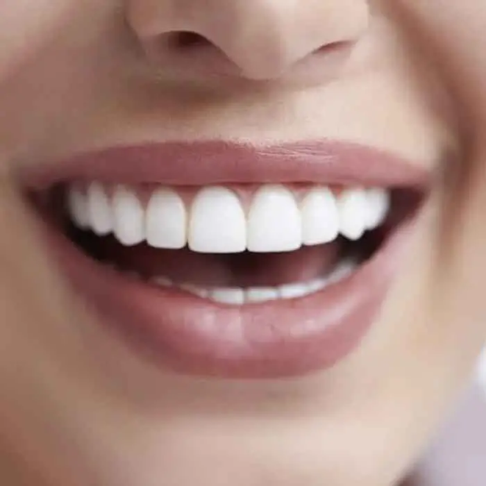 Increased tooth sensitivity and discomfort