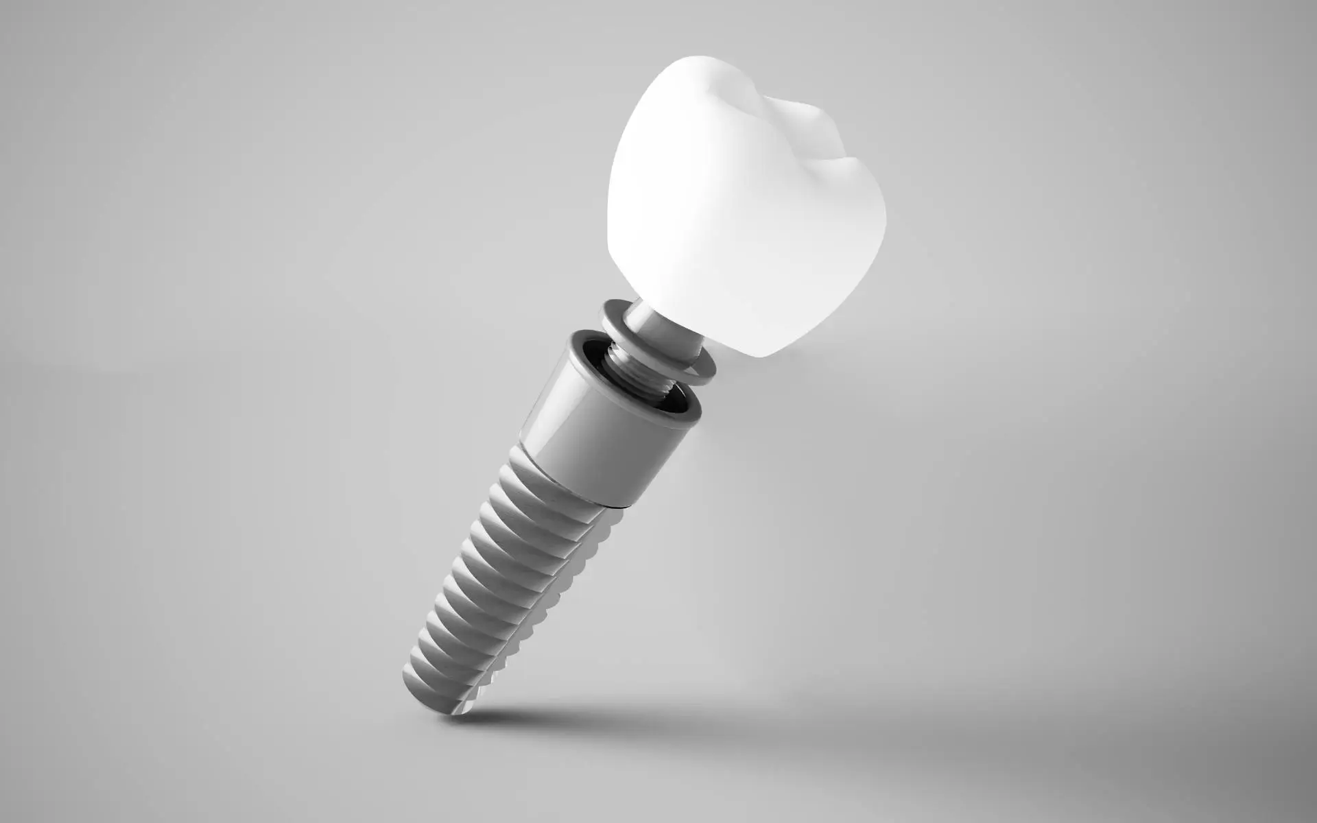 How Long Does A Dental Implant Take From Start To Finish How Long Does A Dental Implant Take From Start To Finish
