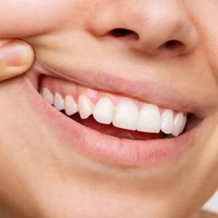 Client Case 2 Wonky Teeth