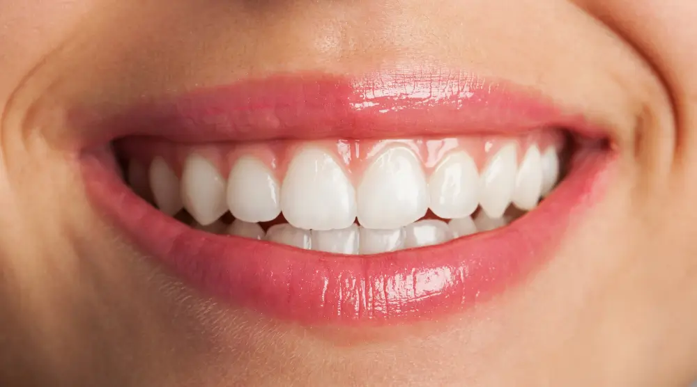 What Is Teeth Whitening